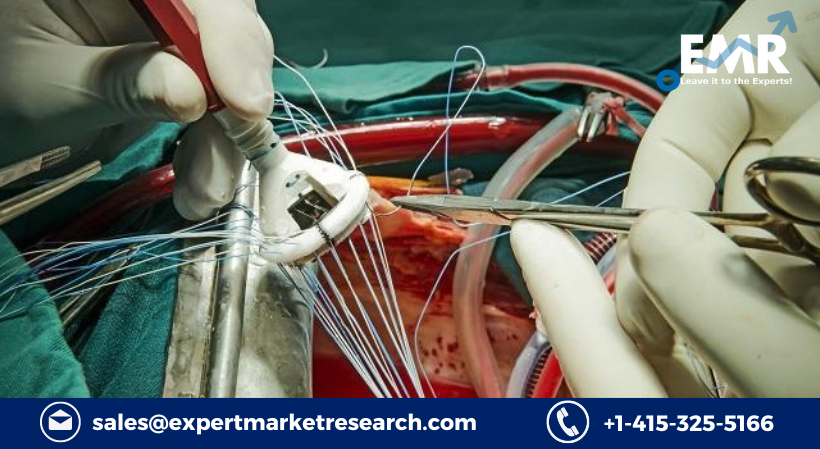Aortic Valve Replacement Market Size