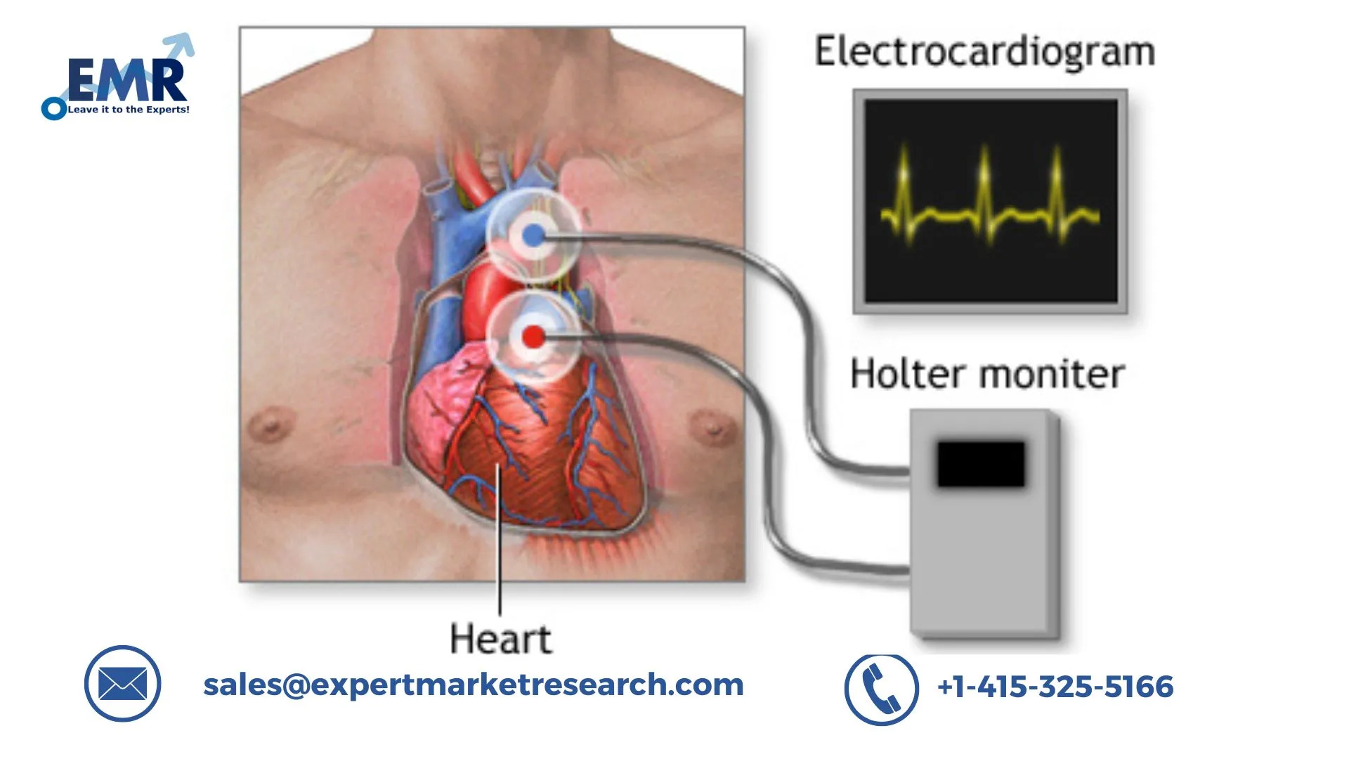 Cardiac Arrhythmia Monitoring Devices Market size