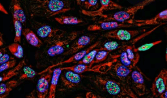 Immunofluorescence of cancer cells