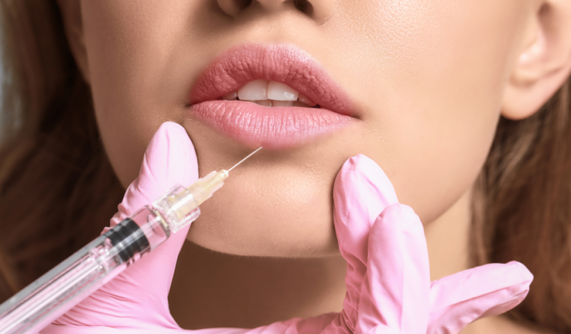 restylane silk lip filler (1)