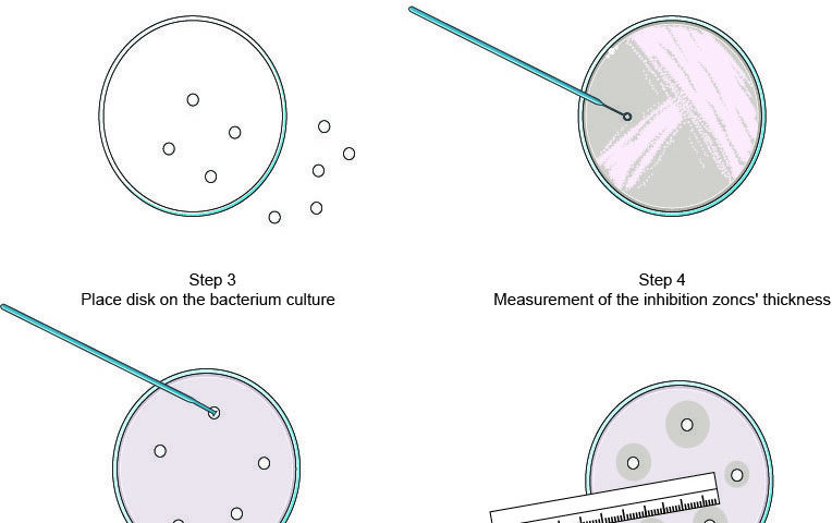 Antimicrobial susceptibility testing
