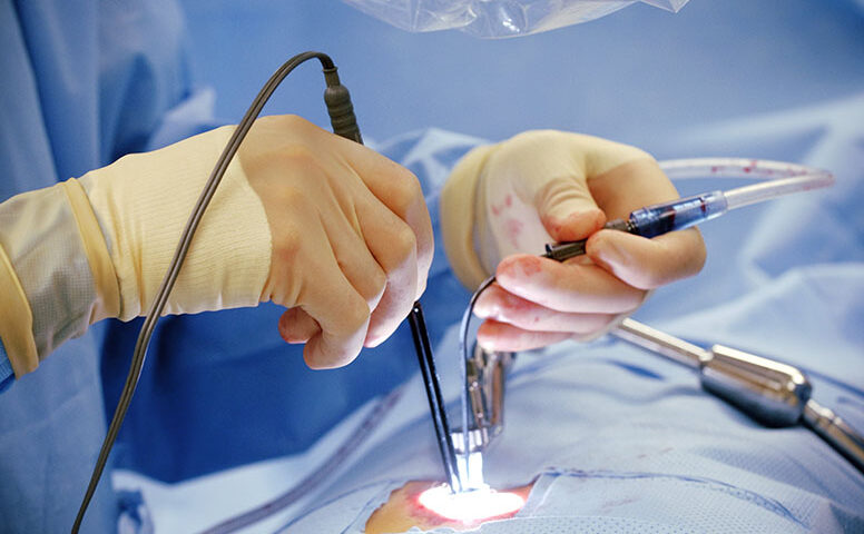 Bariatric surgery devices market Size Worth 3.7  Billion by 2028| CAGR 5.4%