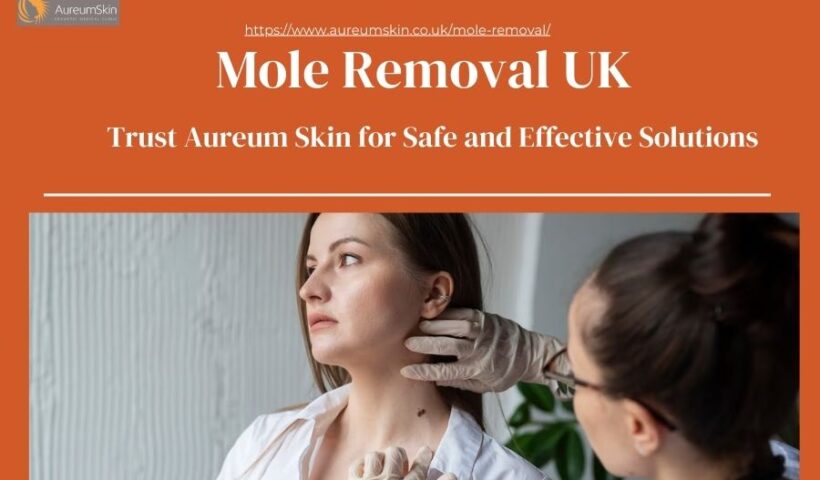 Mole Removal UK
