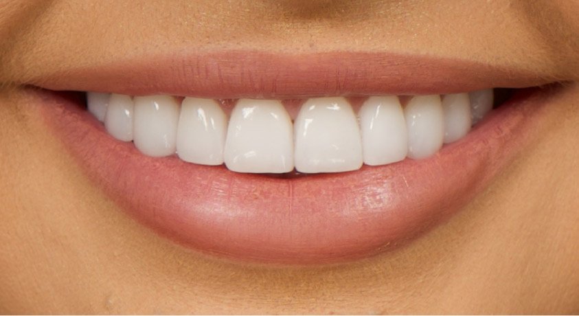 How Cosmetic Dentistry Can Boost Your Confidence and Self-Esteem