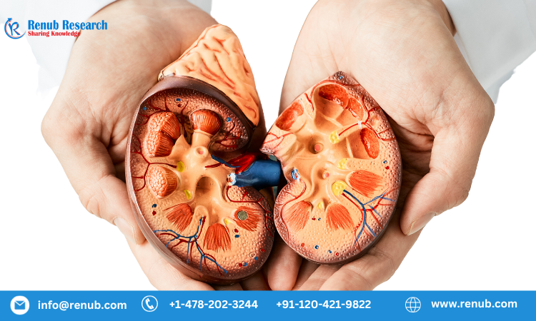 Huntington Disease Treatment Market will be worth US$ 1,284.69 Million by 2030  Renub Research