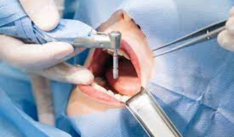 Dental Implant Surgery Challenges