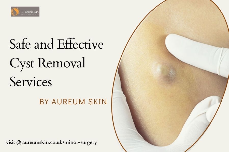 cysts removal services by aureum skin