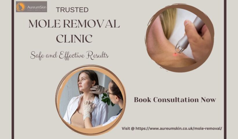 Mole Removal Clinic