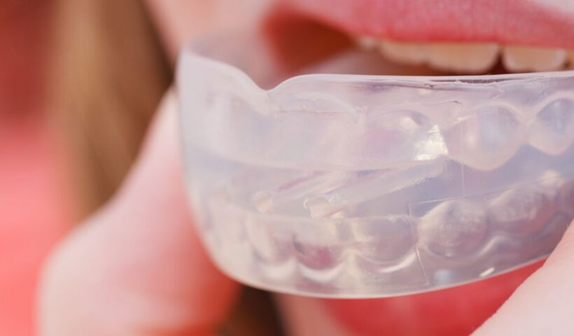mouthguards Melbourne