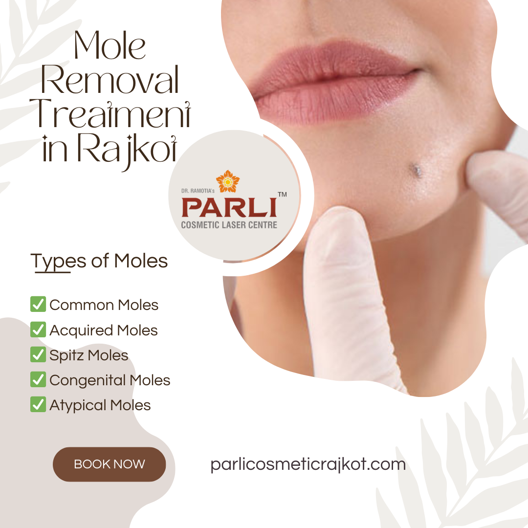 Mole Removal Treatment in Rajkot