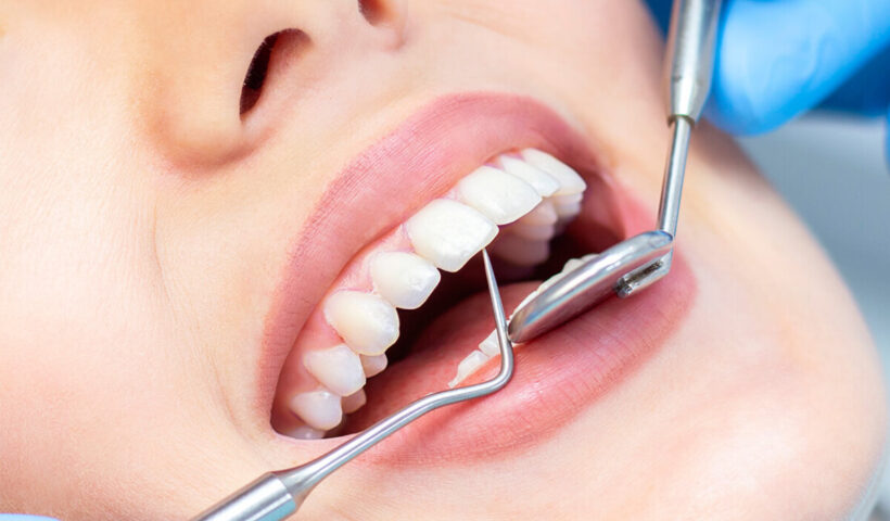 Achieving a Radiant Smile with Deep Teeth Cleaning in Dallas, TX