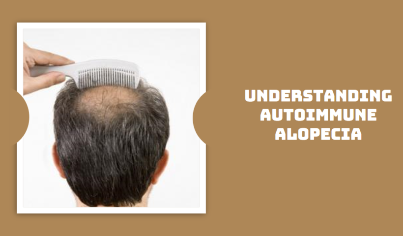 Autoimmune alopecia