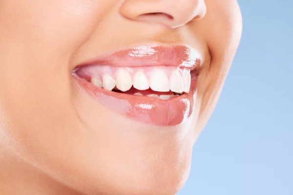 Brighten Your Smile With Teeth Whitening: Say Goodbye To Stains