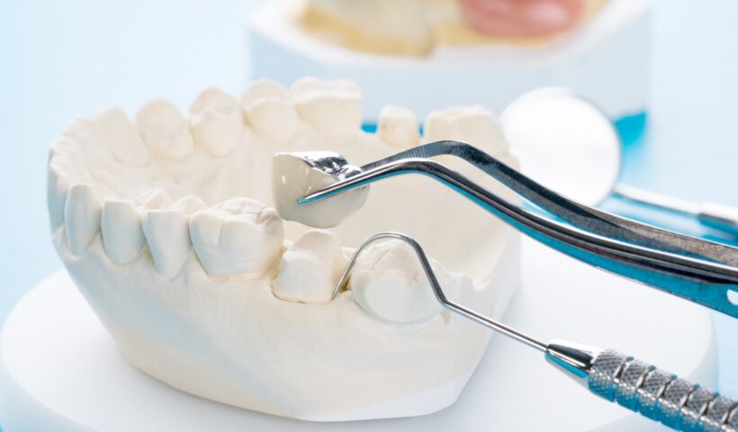Comprehensive Dental Crowns Treatment in Louisville, KY