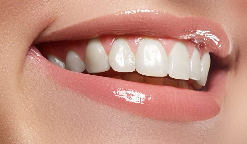 Partial Dentures in Longview, TX: Restoring Smiles with Precision
