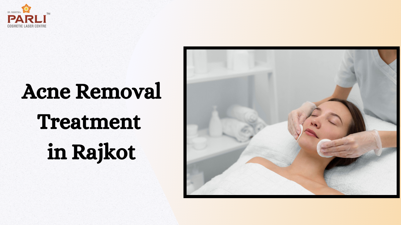 Best acne removal treatment