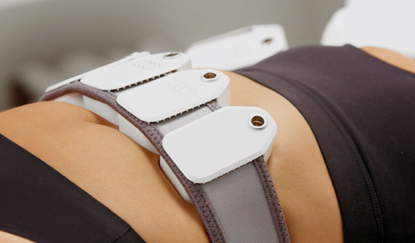 coolsculpting-toronto