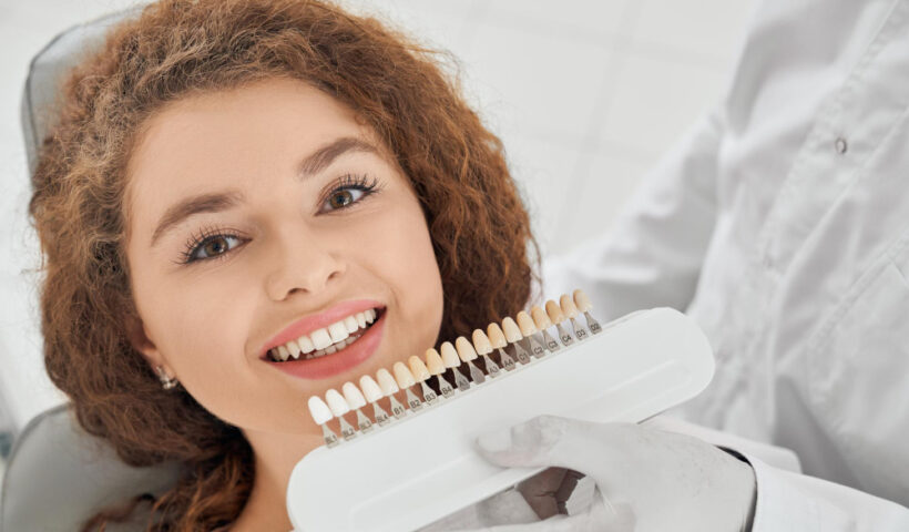 veneers in Camarillo