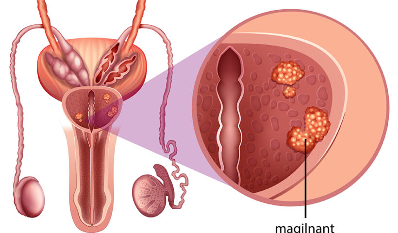 oncologists-in-ahmedabad