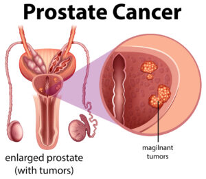 oncologist in ahmedabad