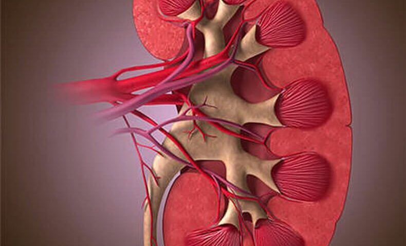 Managing Kidney Issues in Insulin-Resistant Individuals