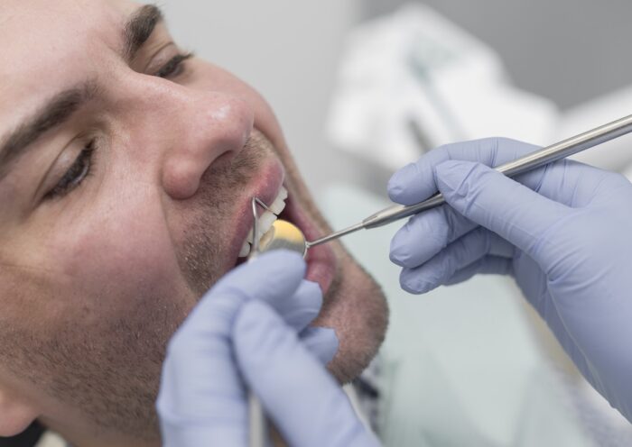 Understanding The Different Types Of Fillings: A General Dentist's Perspective